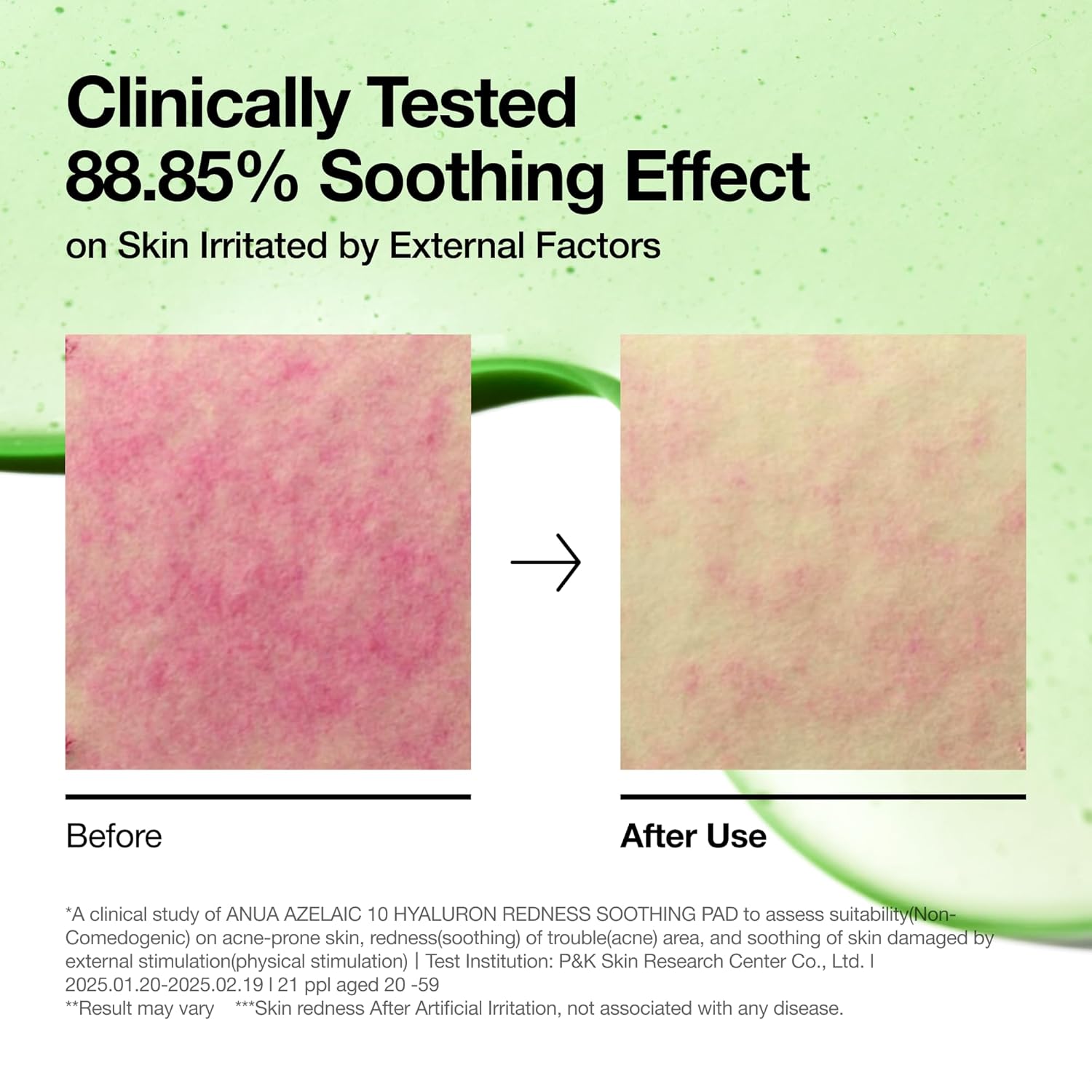 Anua Azelaic 10 Hyaluron Redness Soothing90 Pad 230 ML