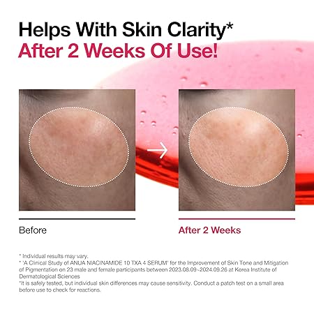 ANUA Niacinamide 10 + TXA 4 Serum% DARK SPOT CORRECTING SERUM 30 ML